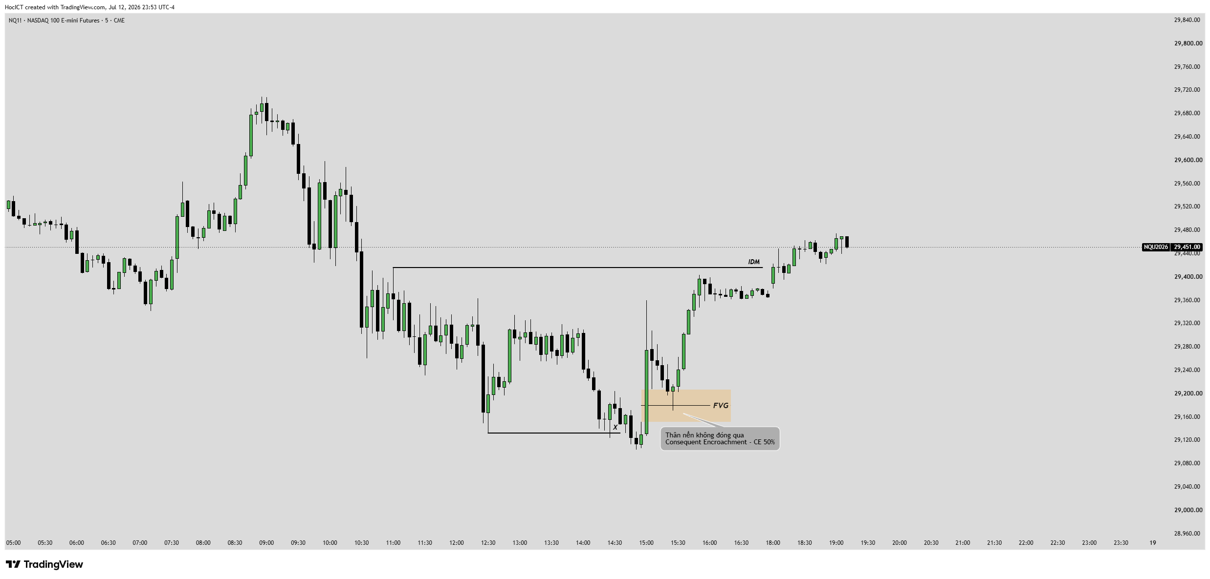 Cấu trúc chi tiết khoảng trống giá trị hợp lý Fair Value Gap FVG trên TradingView